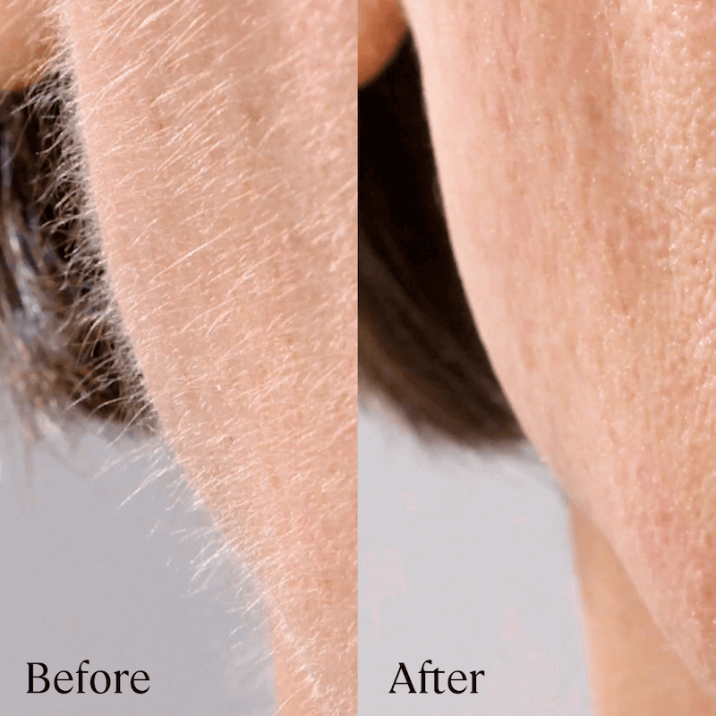 Antes y después: pelusa facial